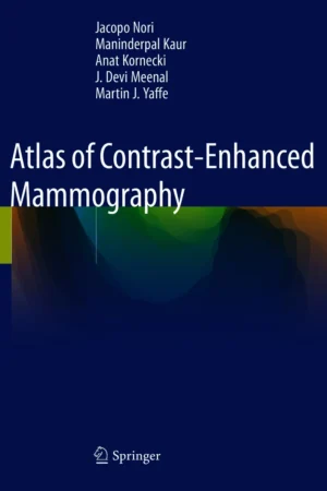 Atlas of Contrast-Enhanced Mammography