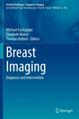Breast Imaging PDF