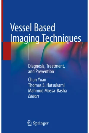 Vessel Based Imaging Techniques Diagnosis