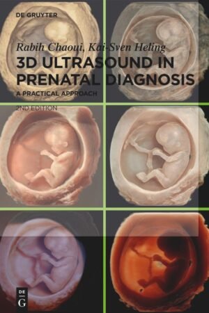 3D Ultrasound in Prenatal Diagnosis 2nd Edition PDF