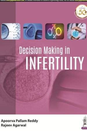 Decision Making in Infertility PDF