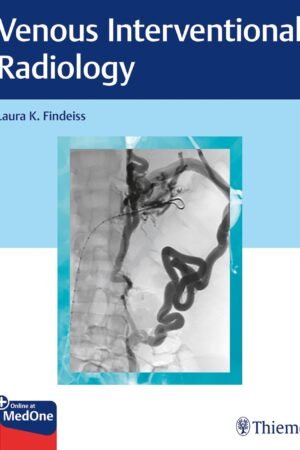 Venous Interventional Radiology