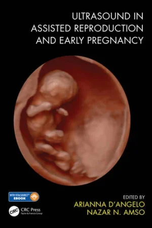 Ultrasound in Assisted Reproduction and Early Pregnancy