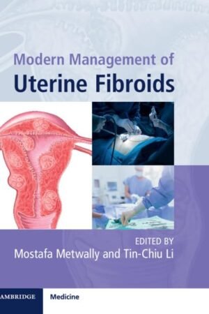 Modern Management of Uterine Fibroids