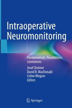 Intraoperative Neuromonitoring: Fundamentals, Possibilities, Limitations