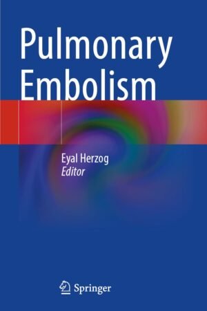 Pulmonary Embolism PDF