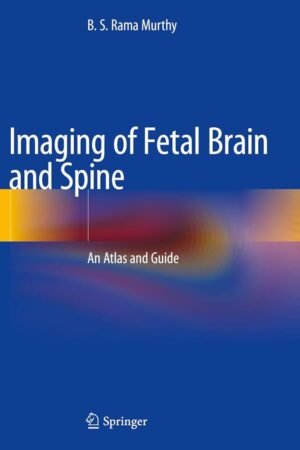 Imaging of Fetal Brain and Spine PDF