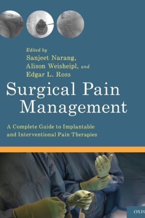Surgical Pain Management
