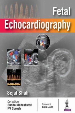 Fetal Echocardiography