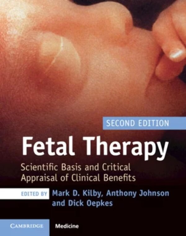 Fetal Therapy 2nd Edition