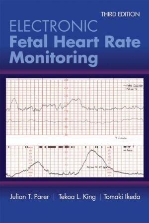 Electronic Fetal Heart Rate Monitoring 3rd Edition