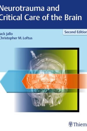 Neurotrauma and Critical Care of the Brain 2nd Edition