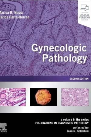 Gynecologic Pathology 2nd Edition
