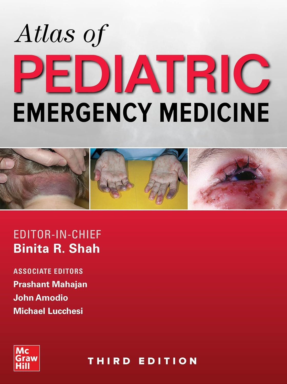 Atlas of Pediatric Emergency Medicine Third Edition