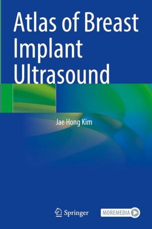 Atlas of Breast Implant Ultrasound PDF