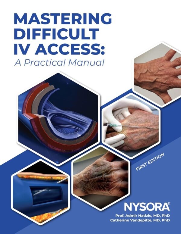 Mastering Difficult IV Access - a Practical Manual