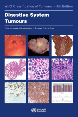 WHO Classification of Tumours. Digestive System Tumours 5th Edition