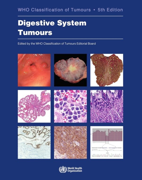 WHO Classification of Tumours. Digestive System Tumours 5th Edition