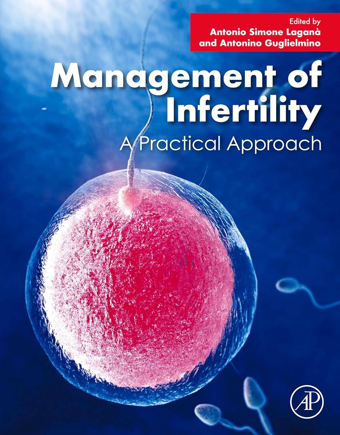Management of Infertility: A Practical Approach