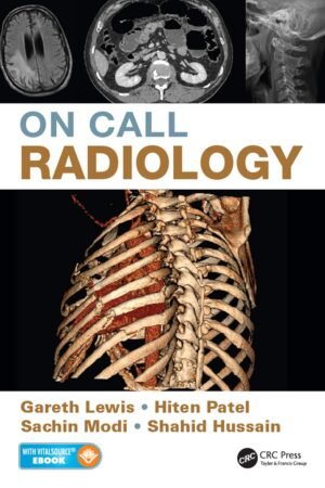 On Call Radiology