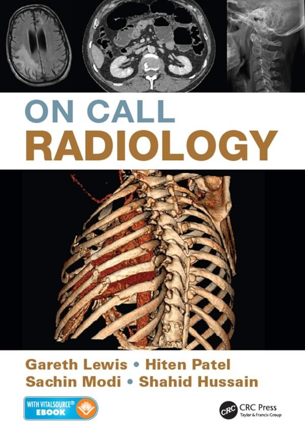 On Call Radiology
