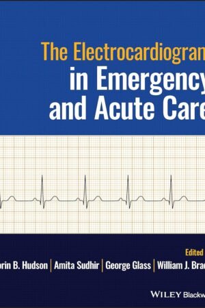 The Electrocardiogram in Emergency and Acute Care