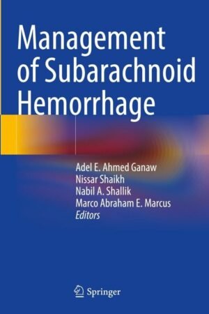 Management of Subarachnoid Hemorrhage