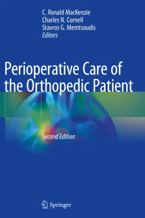 Perioperative Care of the Orthopedic Patient 2nd Edition