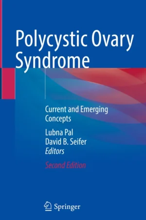 Polycystic Ovary Syndrome 2nd Edition
