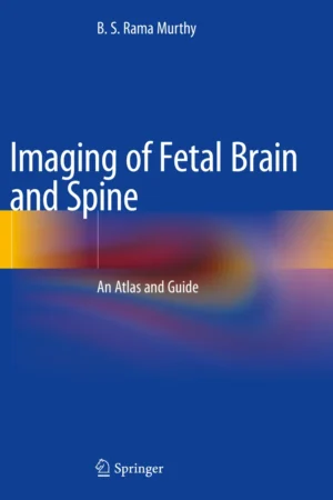 Imaging of Fetal Brain and Spine PDF