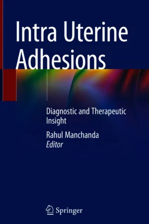 Intra Uterine Adhesions PDF