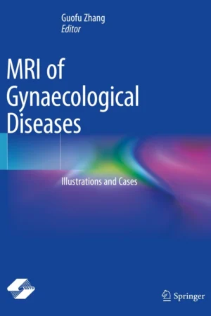 MRI of Gynaecological Diseases
