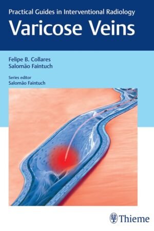 Varicose Veins: Practical Guides in Interventional Radiology PDF