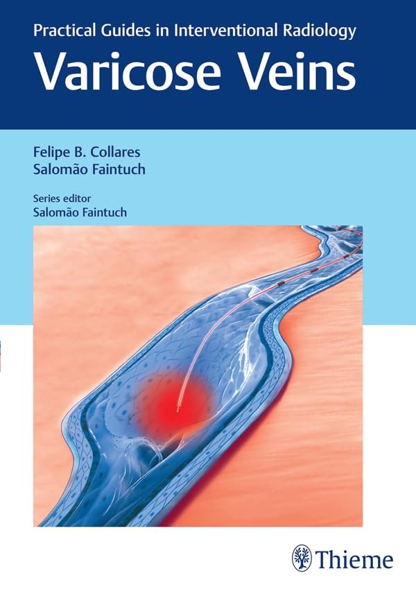Varicose Veins: Practical Guides in Interventional Radiology PDF