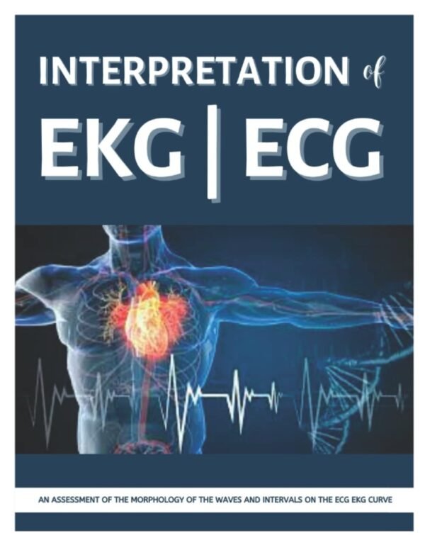Interpretations of EKG | ECG