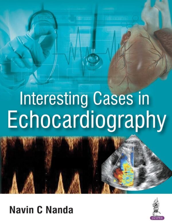 Interesting Cases in Echocardiography