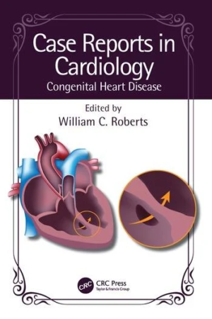 Congenital Heart Disease PDF