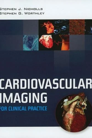 Cardiovascular Imaging For Clinical Practice PDF