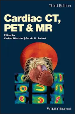 Cardiac CT, PET, and MR 3rd Edition PDF