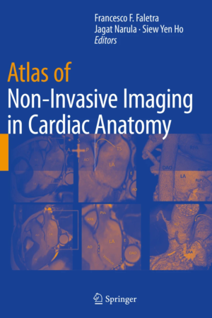 Atlas of Non-Invasive Imaging in Cardiac Anatomy PDF