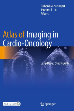 Atlas of Imaging in Cardio-Oncology PDF