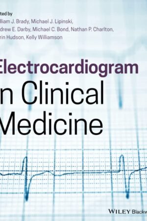 Electrocardiogram in Clinical Medicine