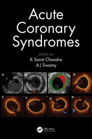 Acute Coronary Syndromes PDF