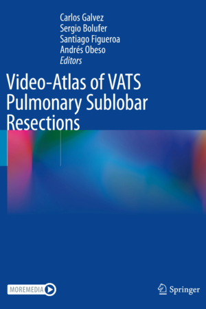 Video-Atlas of VATS Pulmonary Sublobar Resections PDF