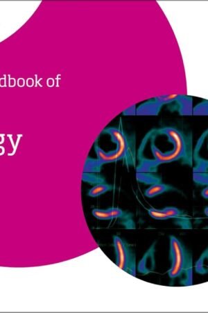 The EACVI Handbook of Nuclear Cardiology