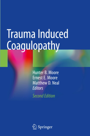Trauma Induced Coagulopathy PDF