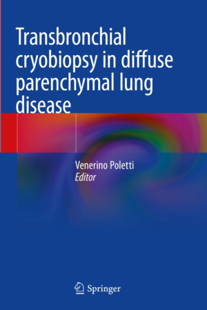 Transbronchial Cryobiopsy in Diffuse Parenchymal Lung Disease PDF