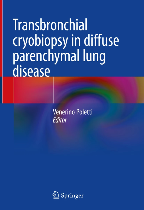 Transbronchial Cryobiopsy in Diffuse Parenchymal Lung Disease PDF