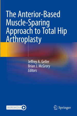The Anterior-Based Muscle-Sparing Approach to Total Hip Arthroplasty PDF