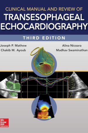 Clinical Manual and Review of Transesophageal Echocardiography 3rd Edition